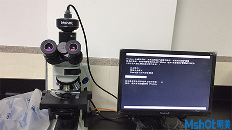 對惡性腫瘤進行診斷與鑒別