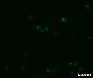 明美倒置熒光顯微鏡助力中國科學技術(shù)大學溶酶體觀察