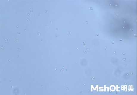國產(chǎn)生物顯微鏡搭配顯微鏡相機觀察到乳酸菌